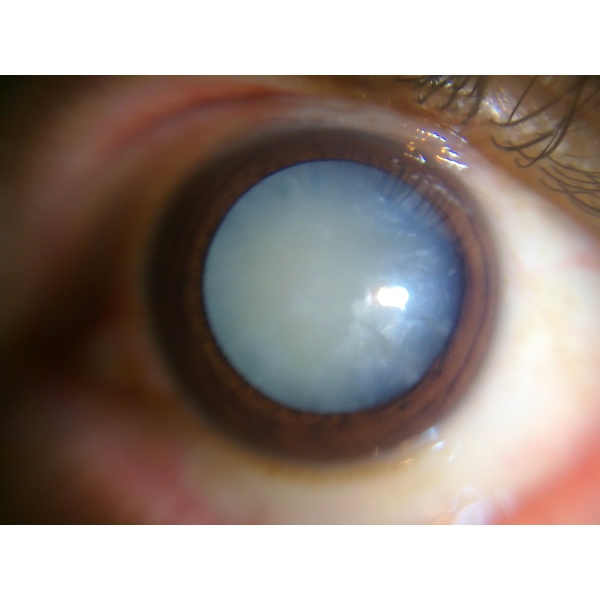 Proscan EyeCare Clinic - Clinictor