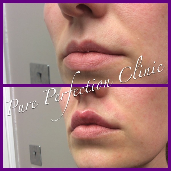 Pure Perfection Clinic - Clinictor