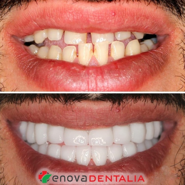 Renova Dental - Clinictor