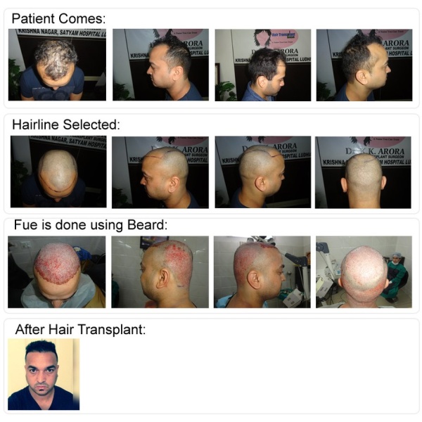 Satyam Hair Transplant Russia - Clinictor