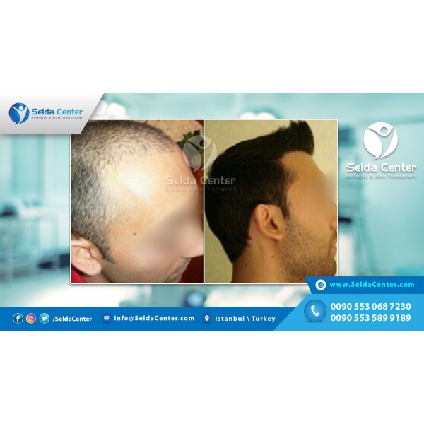 Selda Hair Center - Clinictor