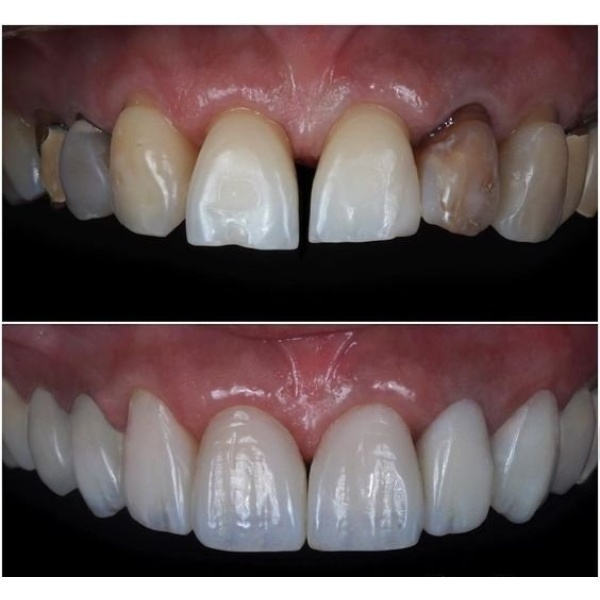Side Dental Centre - Clinictor