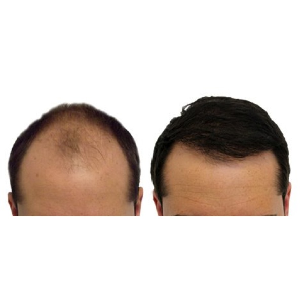 Sizzling Hair Care - Clinictor
