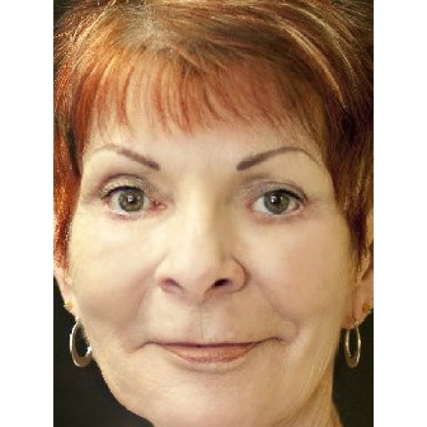 Skin Technologies - Clinictor