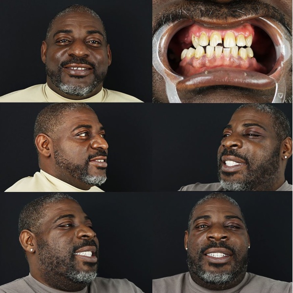 Smile 4ever - Clinictor