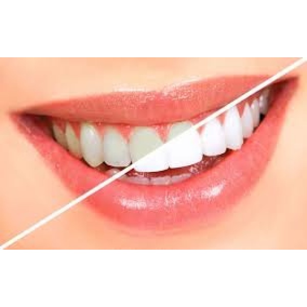 Smile Expedia - Clinictor