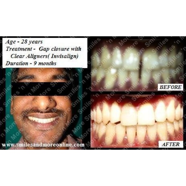 Smiles n More Orthodontic & Invisalign Centre - Clinictor