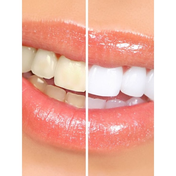 Spark Dental Care - Clinictor