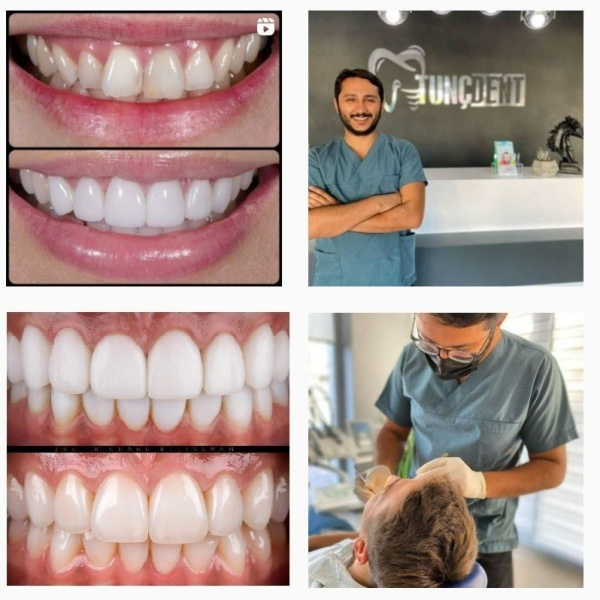 TEETH VENEERS TURKEY - Clinictor