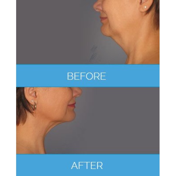 Vaser Clinic - London - Clinictor