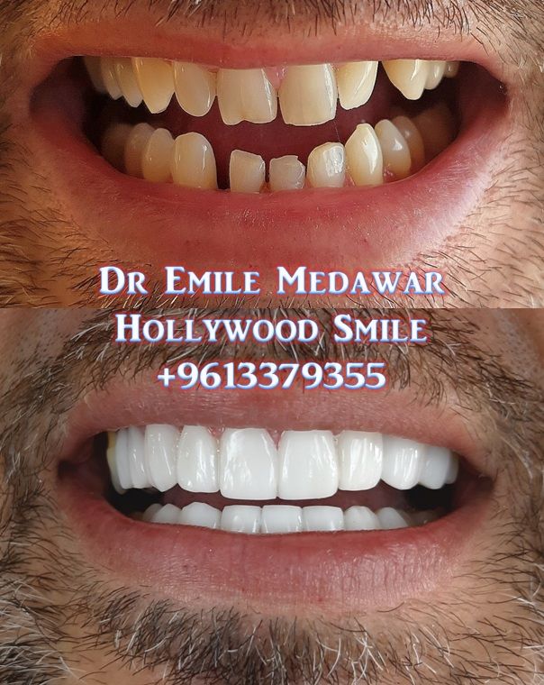 Clinictor - Dentist lebanon Dr Emile Medawar