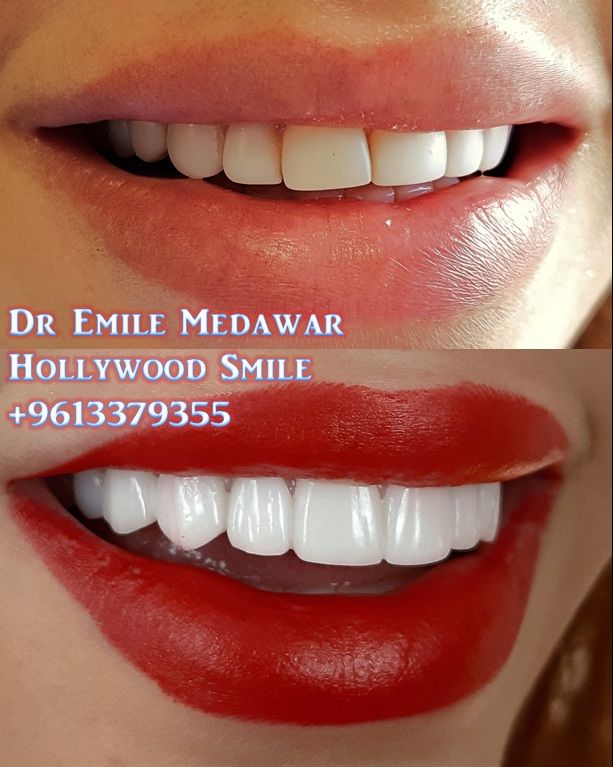 Clinictor - Dentist lebanon Dr Emile Medawar