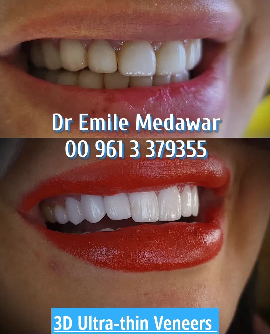 Clinictor - Dentist lebanon Dr Emile Medawar