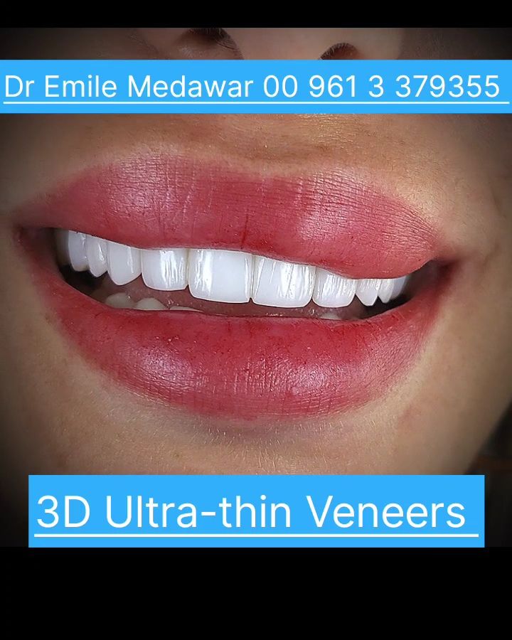 Clinictor - Dentist lebanon Dr Emile Medawar