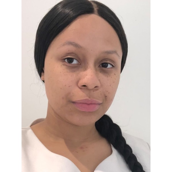 Clinictor - Edgbaston Wellness & Medispa - Charly