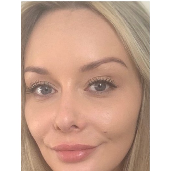 Clinictor - Jane Wilson Aesthetics - Primrose Cottage - Corinne Moore