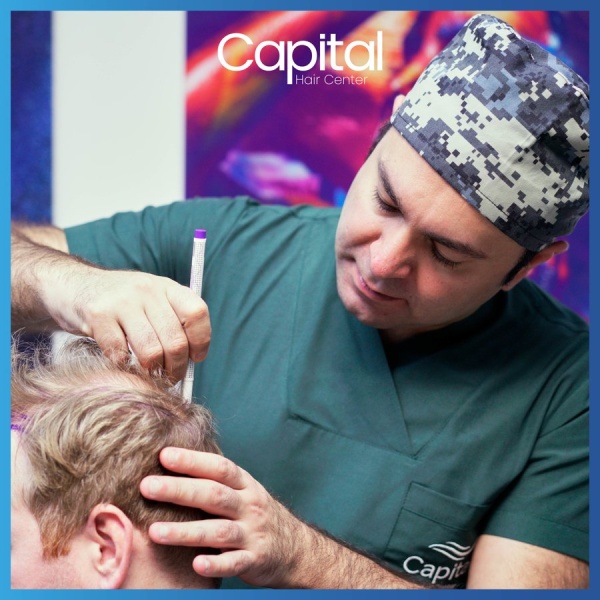 Clinictor - Capital Hair Center - Dr Ekrem Keskin