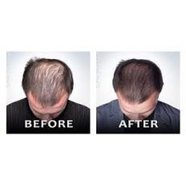 Clinictor - skinmekover-The clinic - Dr . Kumar