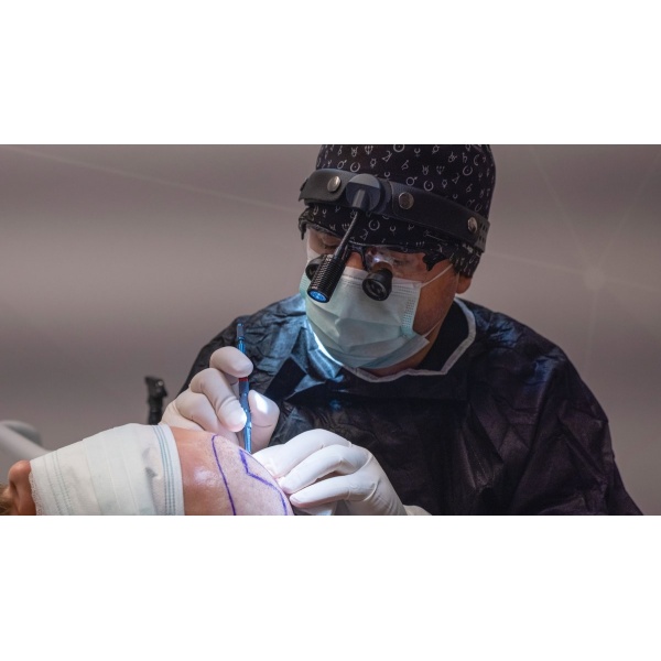 Clinictor - Cosmedica Clinic Hair Transplant - Dr Levent Acar