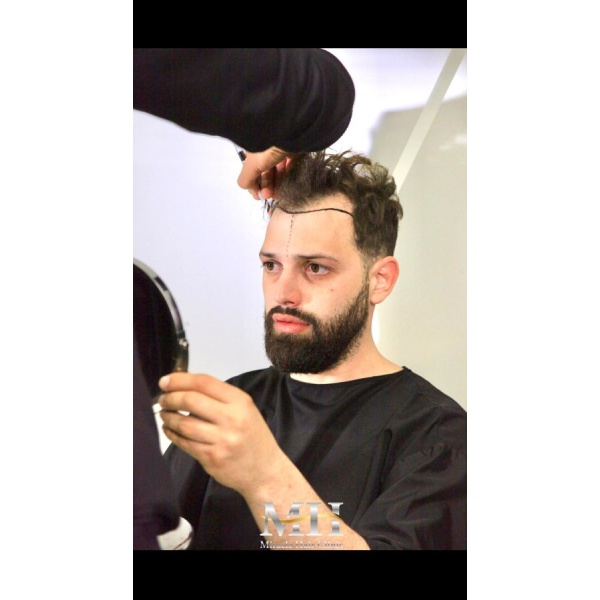 Clinictor - Miracle Hair Clinic Turkey - Dr Miracle Hair