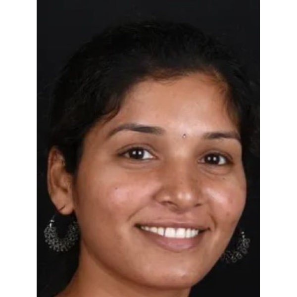 Clinictor - Arcus Plastic Surgery & Dental Clinic - Dr Padmaja Dhanireddy