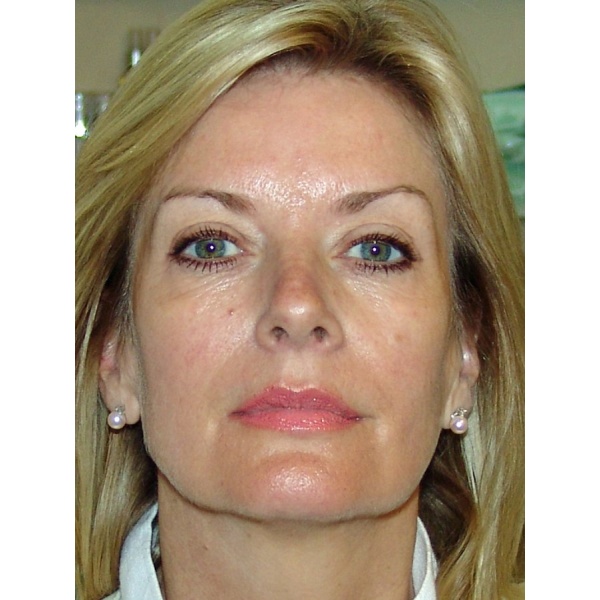 Clinictor - Stratford Dermatherapy Clinic - Stratford-upon-Avon - Mrs Carron Kitchen