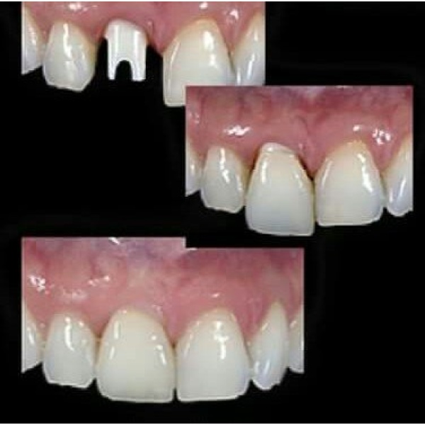 Clinictor - Implants Dental Center - Ms Brenda Castro